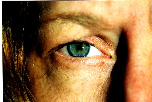 Augen